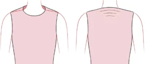 ایراد اندامی شانه مربعی