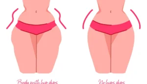 رفع ایراد اندامی پهلوی برجسته در دامن